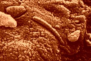 Mars Rock ALH84001 Bacteria
