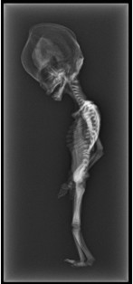 Atacama Alien - ‘Ata’s’ X-Rays