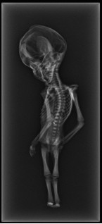 Atacama Alien - ‘Ata’s’ X-Rays