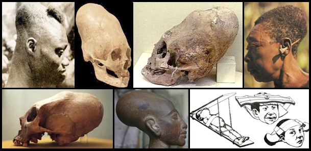 Elongated Skull