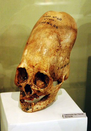 Elongated Skull